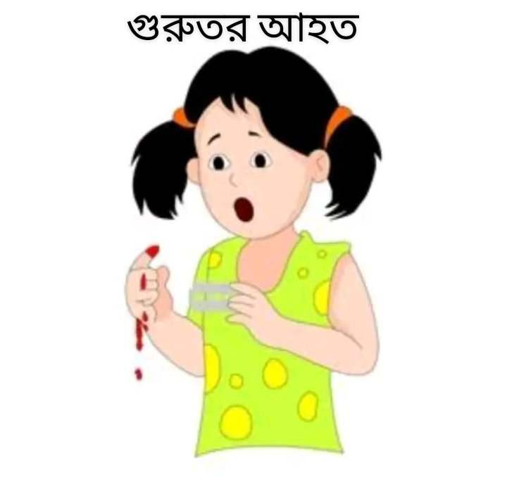 মহম্মদপুরে মডেল সরকারি প্রাথমিক বিদ্যালয়ের শিশু লামিসাকে ব্লেডাঘাত করে মিশু