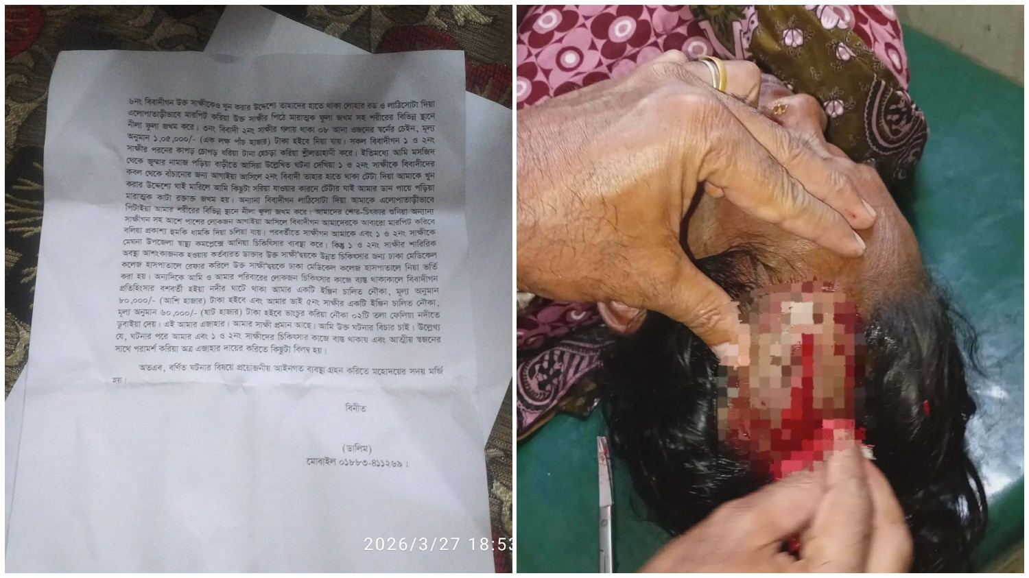 মেঘনার চালিভাঙ্গা ইউনিয়নের মৈশারচর গ্রামে হামলার ঘটনা: নারীসহ একাধিক আহত, এলাকায় আতঙ্ক!